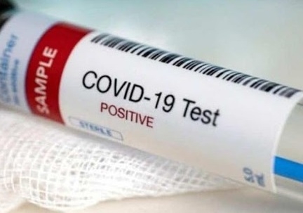 Впродовж доби у Тернополі зафіксували 17 нових випадків COVID-19