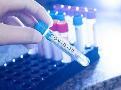 У Тернополі лабораторно підтвердили 54 нових випадки COVID-19