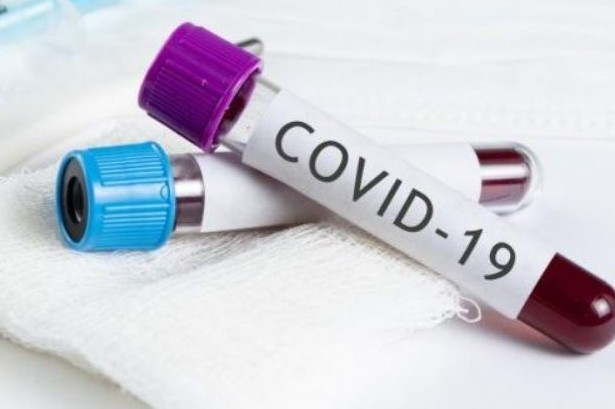Кількість хворих на COVID-19 в Тернополі продовжує зростати