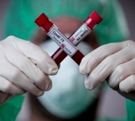 899 осіб одужали від COVID-19 за попередню добу на Тернопільщині