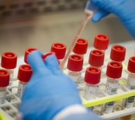 За попередню добу у Тернопільській громаді лабораторно підтверджено 268 нових випадків COVID-19