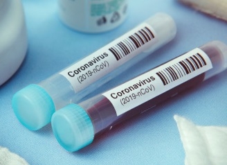 За попередню добу в Тернополі зафіксували 35 нових випадків COVID-19